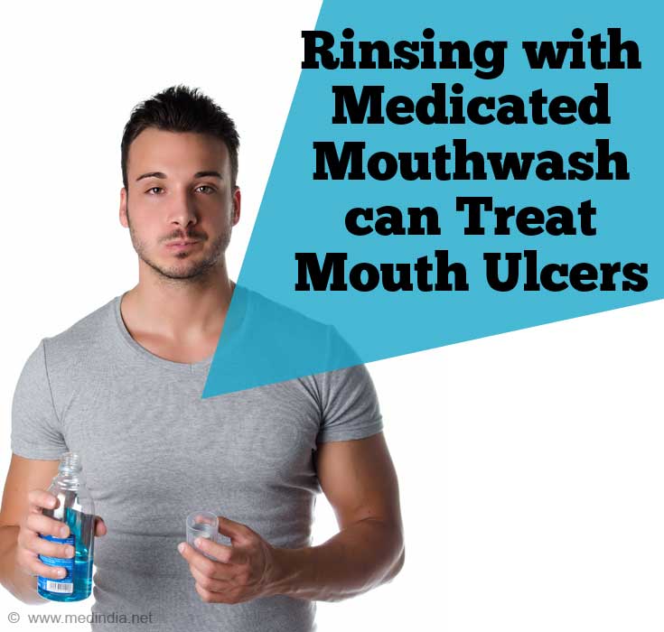 Treatment of Mouth Ulcers - Rinse Your Mouth with Mouthwash Treatment of Mouth Ulcers - Rinse Your Mouth with Mouthwash